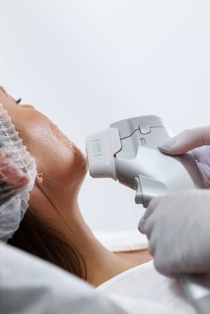 IPL facial y BBL: cómo actúan sobre manchas y rojeces